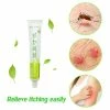 Qian 1pcs Anti-itching Cream Mosquito Bites Ointment Antibacterial Cream Chinese Herbal Medical Plaster Baby Adult Health Care Tc112